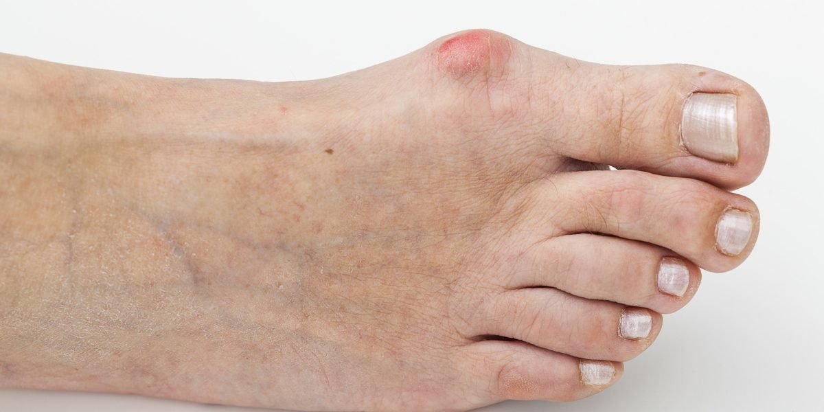 ¿Qué son los Causas, tipos, síntomas y tratamiento